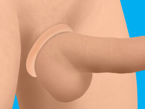 Discreet Silicone Cock Ring Set - Light